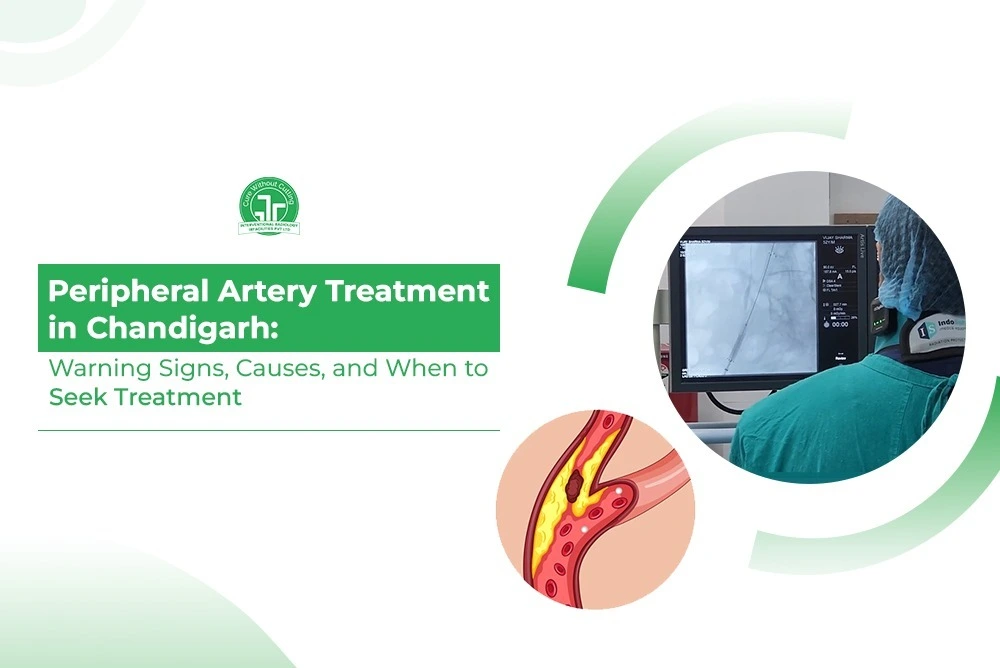 Carotid Artery Stenting A Minimally Invasive Treatment for Carotid Artery Blockage